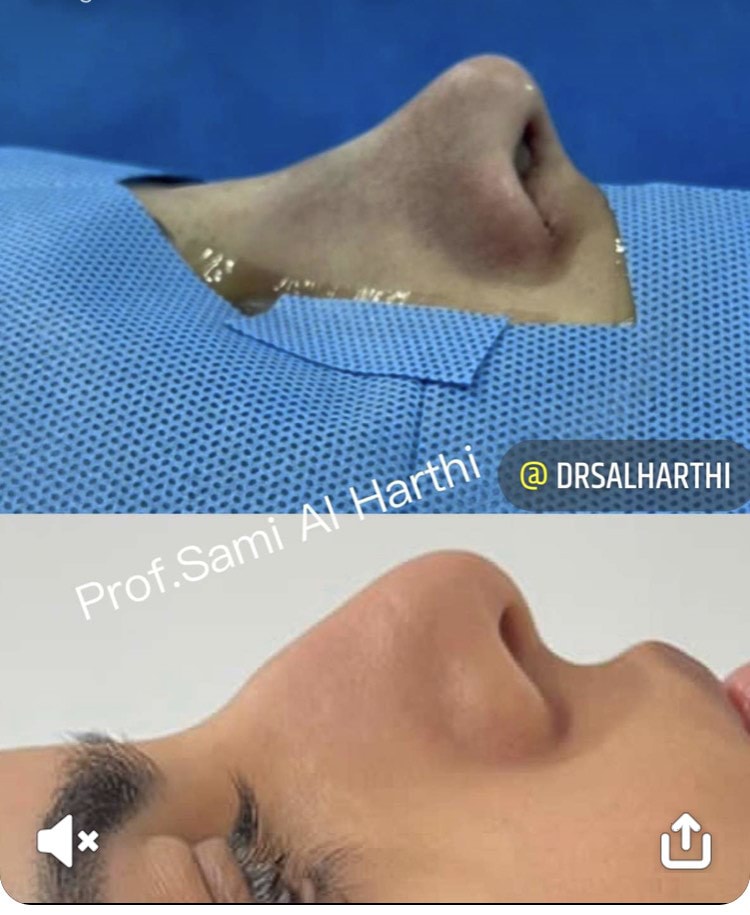 دكتور سامي الحارثي